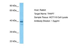 THAP7 Rabbit anti-Human, Polyclonal, Novus Biologicals 0.1ml; Unconjugated:Antibodies,